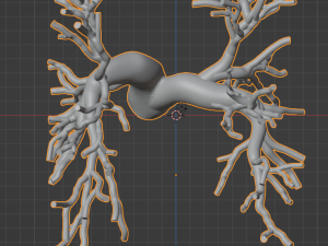 Pulmonary arteries 3D Model