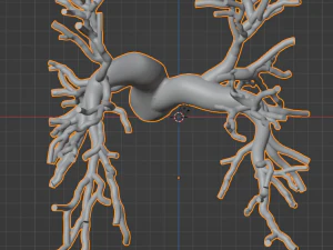 Pulmonary arteries 3D Model