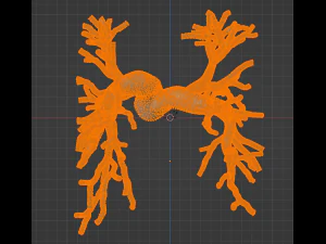 Pulmonary arteries 3D Model