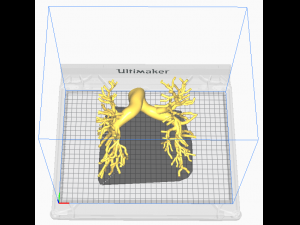 Pulmonary arteries 3D Model