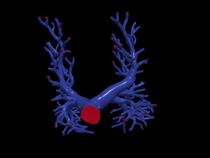 肺动脉 3D 模型