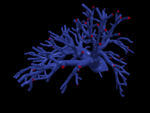 Pulmonary arteries 3D 모델