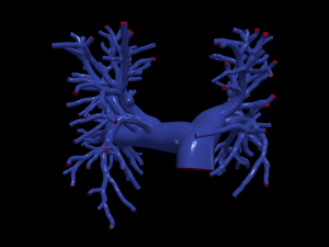 Pulmonary arteries 3D 모델