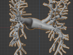 Pulmonary arteries 3D 모델