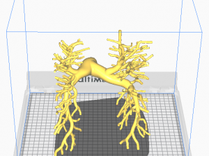 Pulmonary arteries 3D 모델