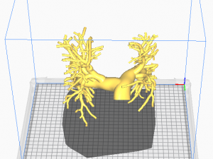 Pulmonary arteries 3D 모델