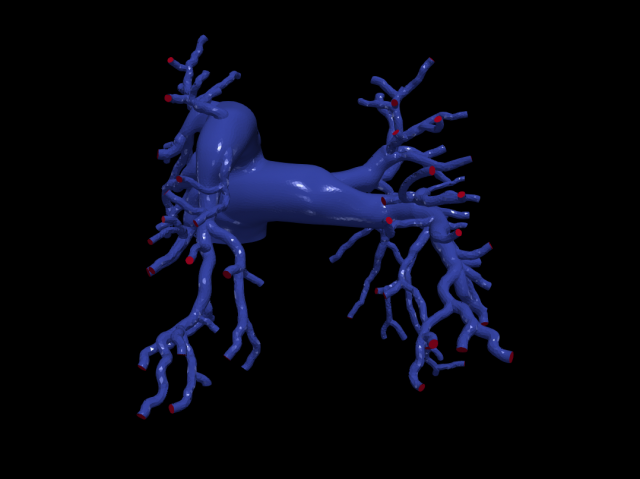 Pulmonary arteries Modelo 3D .c4d .max .obj .3ds .fbx .stl .blend 