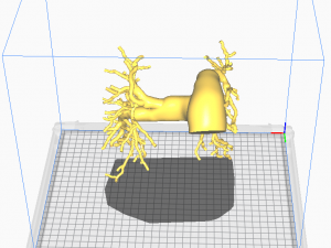 Pulmonary arteries Modelo 3D