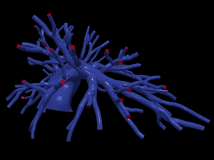 Pulmonary arteries 3D Model