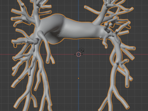 Pulmonary arteries 3D Model