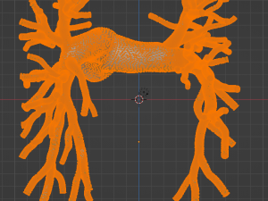 Pulmonary arteries 3D Model