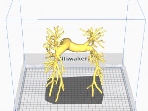 Pulmonary arteries 3D Model