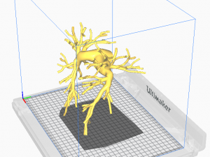 Pulmonary arteries 3D Model