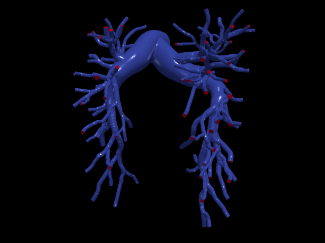 Pulmonary arteries Modelo 3D .c4d .max .obj .3ds .fbx .stl .blend 