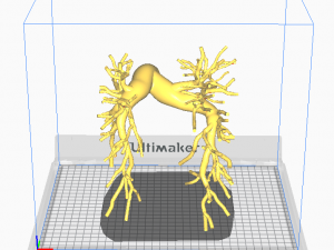 Pulmonary arteries Modelo 3D