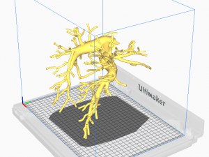 Pulmonary arteries Modelo 3D