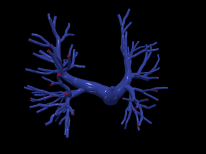 Pulmonary arteries 3D Model