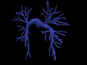 Pulmonary arteries 3D Model