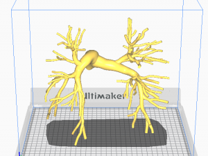 Pulmonary arteries 3D Model