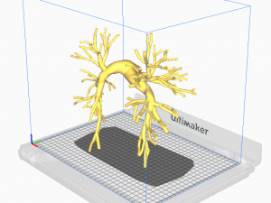 Pulmonary arteries 3D Model