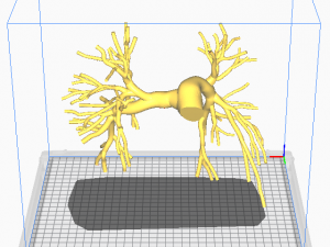Pulmonary arteries 3D Model