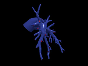 Pulmonary arteries 3D Model