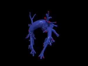 Pulmonary arteries 3D Model