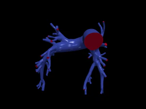 Pulmonary arteries 3D Model