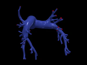 Pulmonary arteries 3D Model