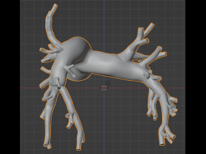 Pulmonary arteries 3D 모델