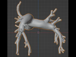 Pulmonary arteries 3D Model