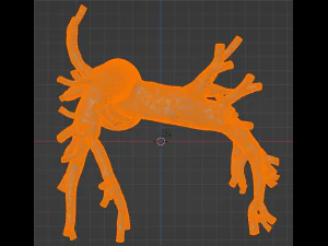 Pulmonary arteries 3D Model