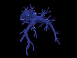 Pulmonary arteries 3D Model