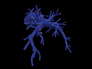 Pulmonary arteries 3D Model