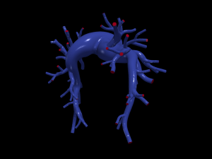 Pulmonary arteries 3D Model
