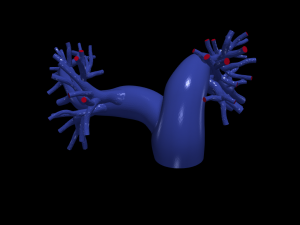 Pulmonary arteries 3D Model