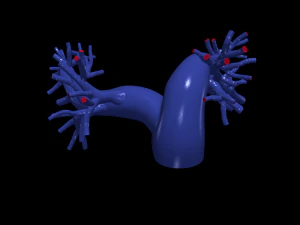 Pulmonary arteries 3D Model