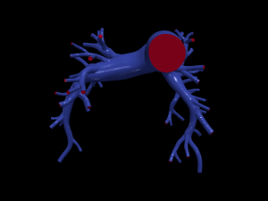 Pulmonary arteries 3D Model
