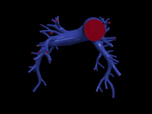 Pulmonary arteries 3D Model