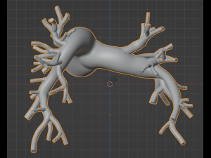Pulmonary arteries 3D Model