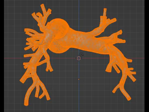 Pulmonary arteries 3D Model