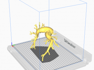 Pulmonary arteries 3D Model