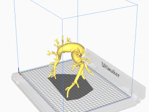Pulmonary arteries 3D Model