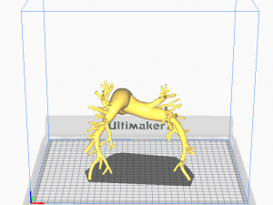 Pulmonary arteries 3D Model
