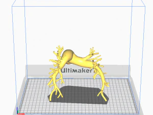 Pulmonary arteries 3D Model