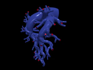 Pulmonary arteries 3D Model