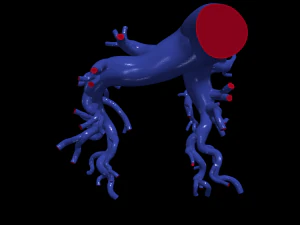 Pulmonary arteries 3D Model
