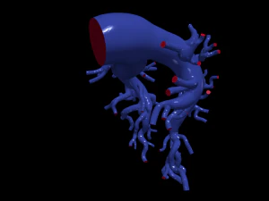 Pulmonary arteries 3D Model
