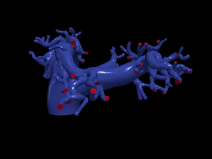 Pulmonary arteries 3D Model