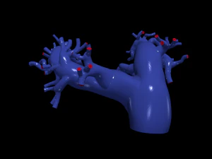 Pulmonary arteries 3D Model